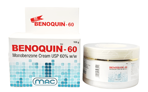 백반증 고농도 모노벤존 크림 베노퀸 BENOQUIN CREAM 40%